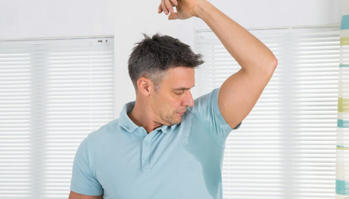 5 Treatment Options for Hyperhidrosis
