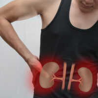 3 Signs of Renal Cancer