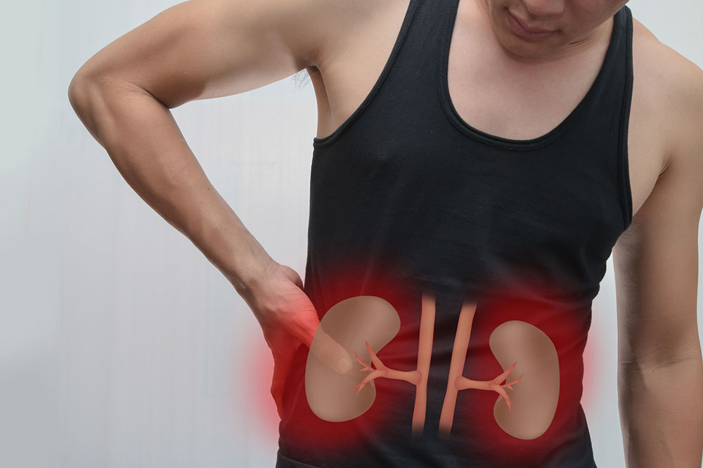 3 Signs of Renal Cancer