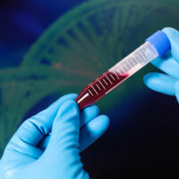 Tips to Manage Hemophilia