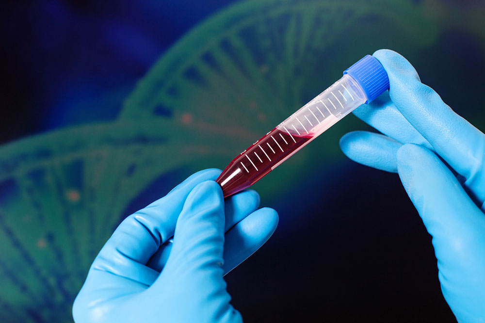Tips to Manage Hemophilia